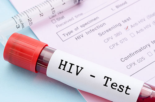 HIV test blood tube