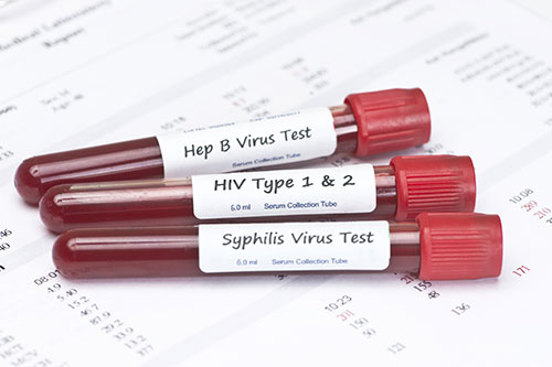 std-blood-test-vials