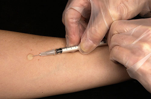 syringe injecting tb test